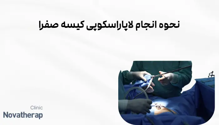 نحوه انجام لاپاراسکوپی کیسه صفرا