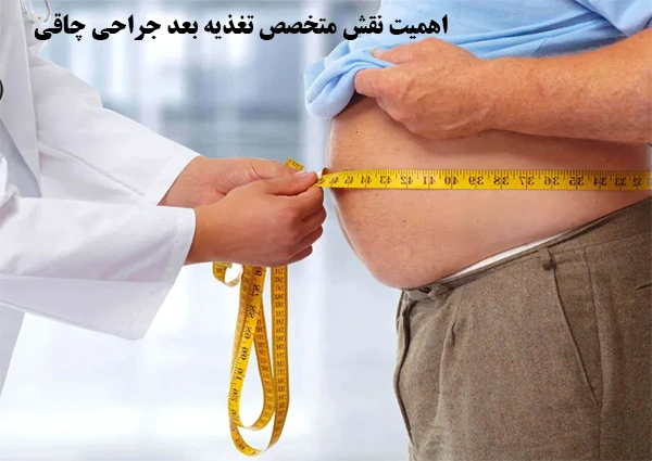 نقش متخصص تغذیه بعد جراحی چاقی
