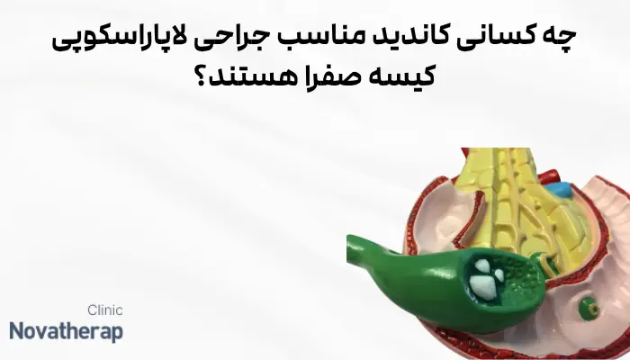 چه کسانی کاندید مناسب جراحی لاپاراسکوپی کیسه صفرا هستند؟