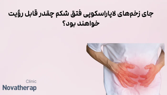 جای زخمهای لاپاراسکوپی فتق شکم چقدر قابل رؤیت خواهند بود؟