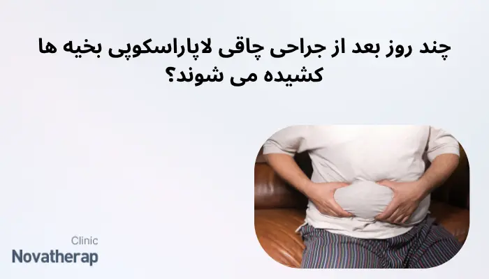 چند روز بعد از جراحی چاقی لاپاراسکوپی بخیه ها کشیده می شوند؟