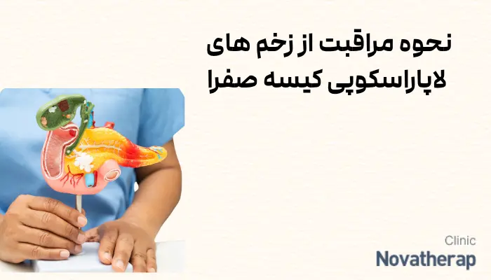 نحوه مراقبت از زخم های لاپاراسکوپی کیسه صفرا