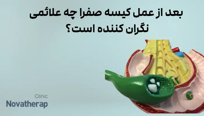  بعد از عمل کیسه صفرا چه علائمی نگران‌ کننده است؟