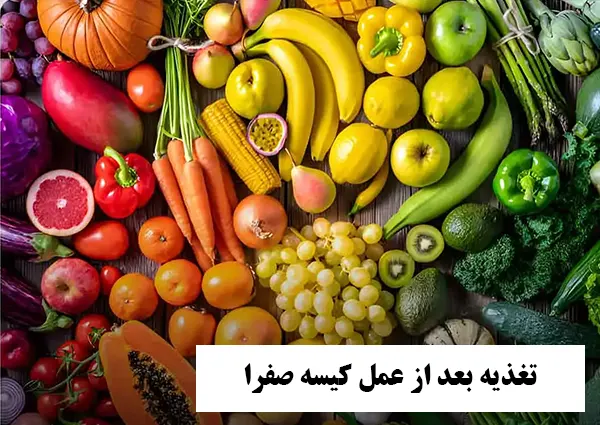 غذاخوردن بعد از عمل کیسه صفرا
