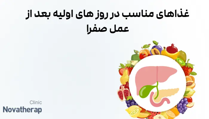غذاهای مناسب در روز های اولیه بعد از عمل صفرا