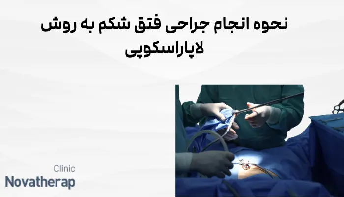 نحوه انجام جراحی فتق شکم به روش لاپاراسکوپی