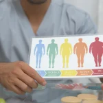 حداقل وزن عمل اسلیو معده + شرایط جراحی