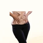 جلوگیری از افتادگی پوست بعد از عمل اسلیو:نکات طلایی