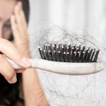 ریزش مو بعد اسلیو معده: پیشگیری و مراقبت