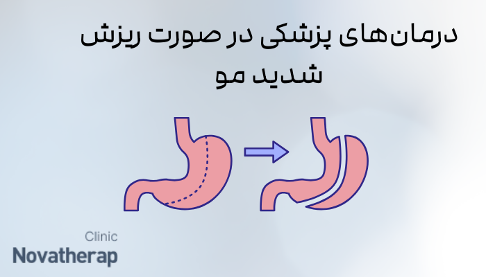 درمان‌های پزشکی در صورت ریزش شدید مو