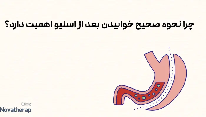 چرا نحوه صحیح خوابیدن بعد از اسلیو اهمیت دارد؟