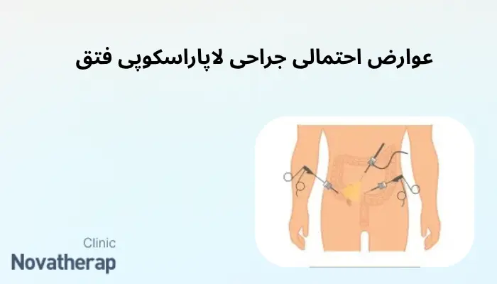 عوارض احتمالی جراحی لاپاراسکوپی فتق عوارض احتمالی جراحی لاپاراسکوپی فتق