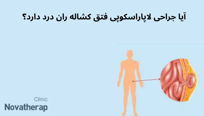 آیا جراحی لاپاراسکوپی فتق کشاله ران درد دارد؟ آیا جراحی لاپاراسکوپی فتق کشاله ران درد دارد؟