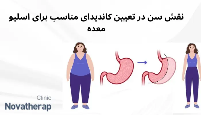 نقش سن در تعیین کاندیدای مناسب برای اسلیو معده نقش سن در تعیین کاندیدای مناسب برای اسلیو معده