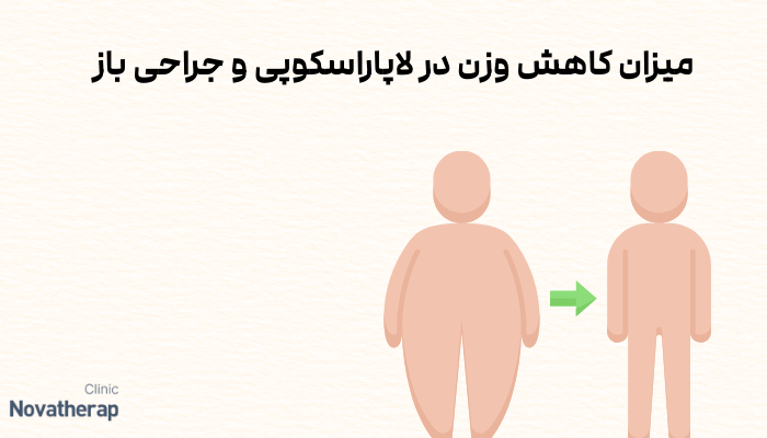 میزان کاهش وزن در لاپاراسکوپی و جراحی باز